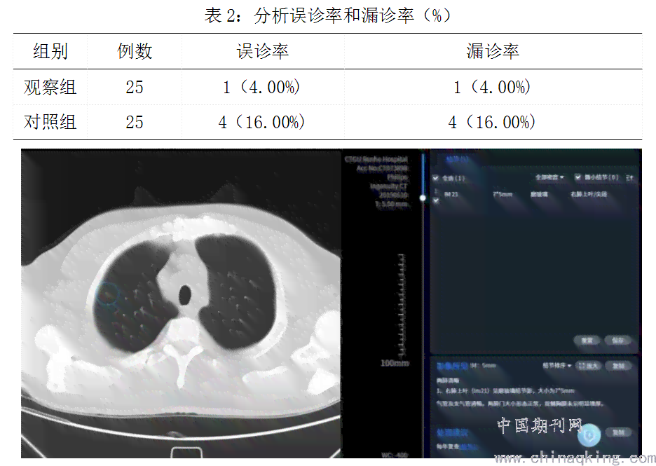 肺结节AI分析的优点：全面概述及其优势特点