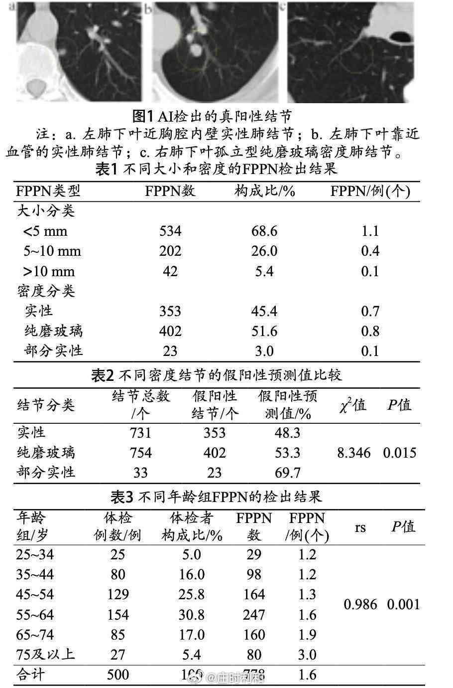 ai智能分析肺微小结节标准报告