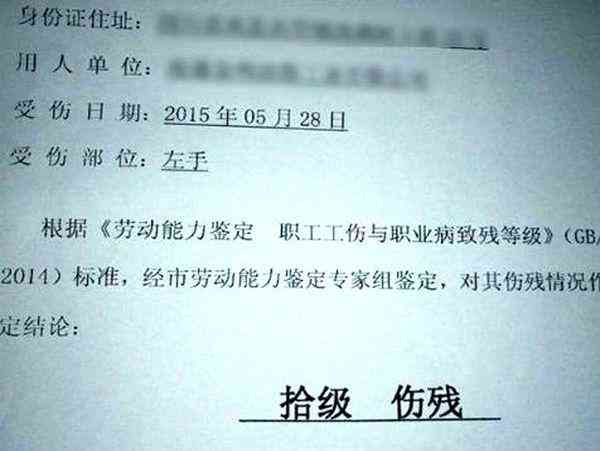 '工伤评定标准：哪些情况可被认定为十级工伤'