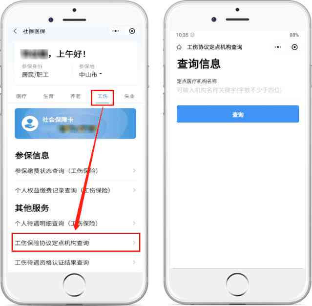 眼nn怎么样的伤算工伤：工伤认定标准与伤势判定