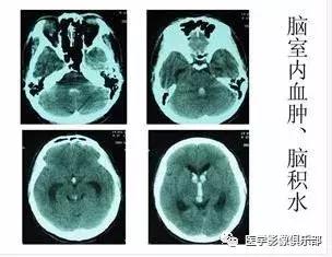 如何判断烫伤严重程度：从轻微到严重烫伤的全面评估指南