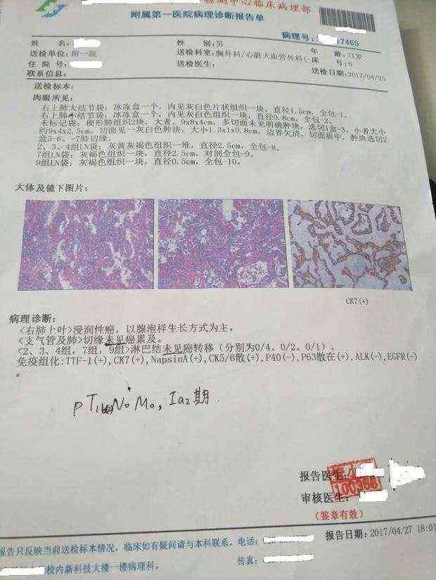 帮忙看报告：请医生协助查看各类检查报告单