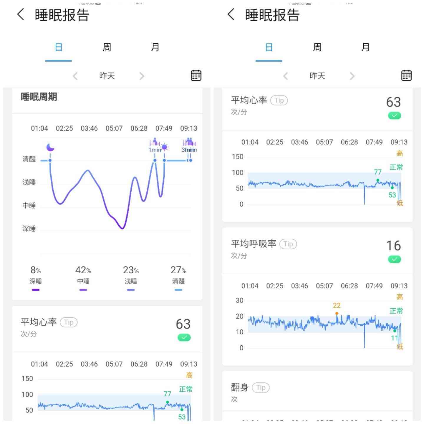 '智能睡眠监测助手：AI生成个性化睡眠质量报告软件'