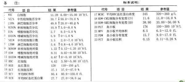 '工伤体检已完成，何时揭晓结果——等待工伤体检报告时间预估'