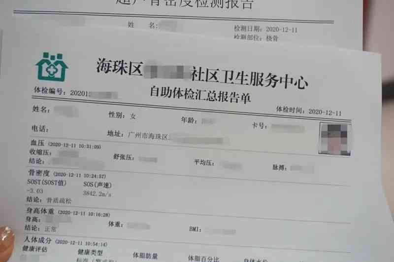 工伤体检做过了等结果什么时候出来，江工伤鉴定体检后多久可出结果？