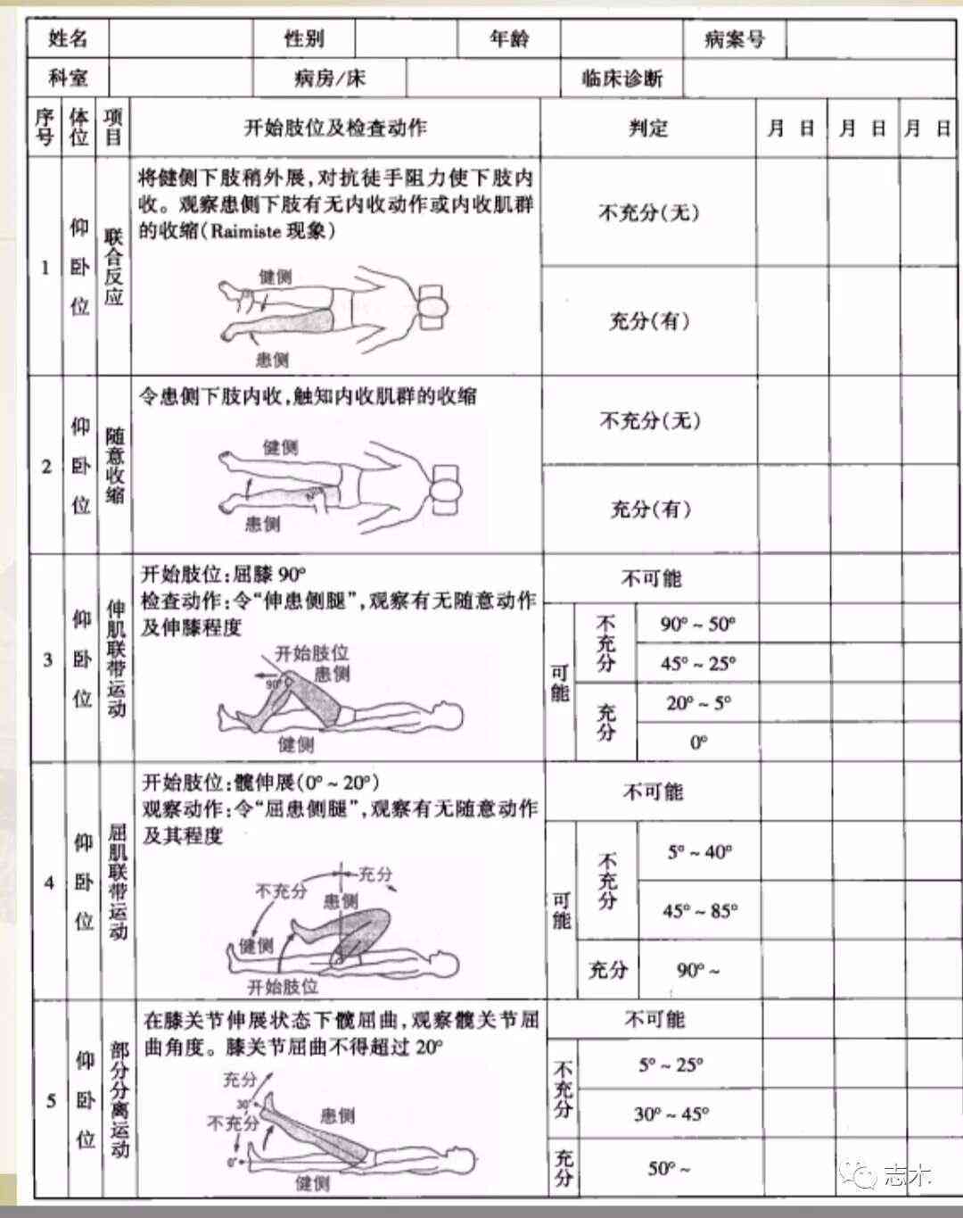 偏瘫患者等级评定标准与方法详析