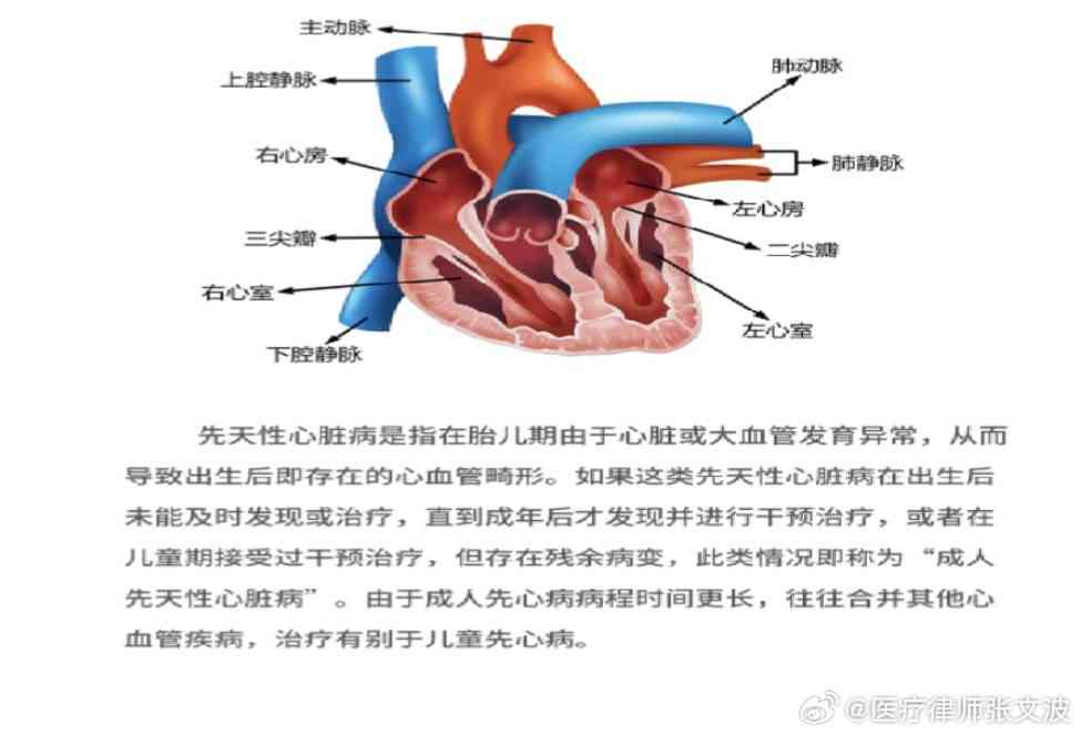 探讨先天性心脏病在职场突发死亡工伤认定的复杂性与可能性