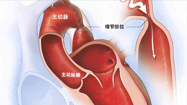 '先天性心脏病在伤残等级评定中被划分为几级伤残？'