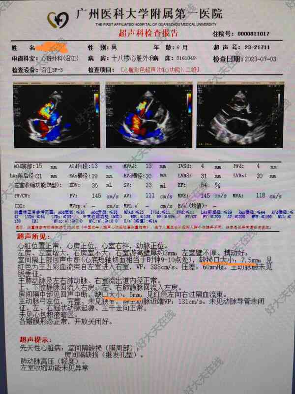 先天性心脏病认定工伤难度