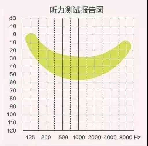 纯音测听报告ai是什么意思呀：解读检测报告含义