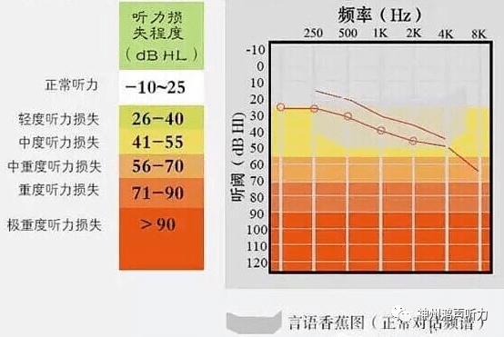 纯音测听ai值正常范围及结果解读：声音数值含义与影响