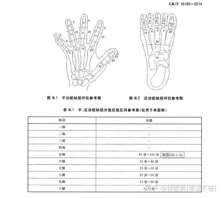 关节炎患者能否依据工伤标准评定工伤等级认定