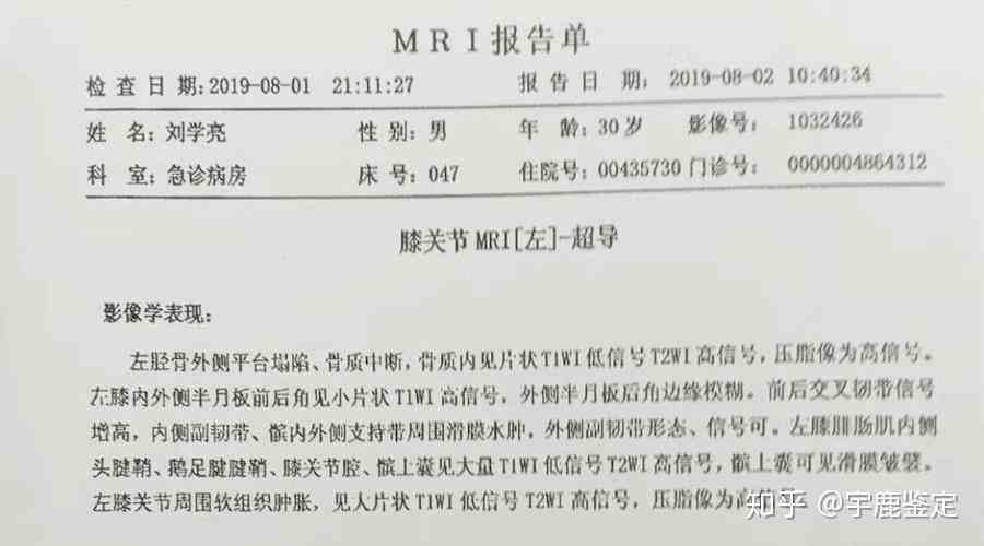 创伤性关节炎的伤残评级标准与认定流程详解