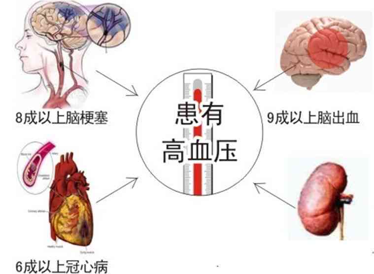 创伤性脑出血有没有可能完全复：治疗与恢复探讨