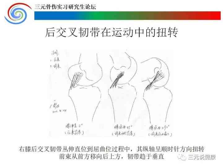 职工运动损伤前交叉韧带断裂获工伤认定