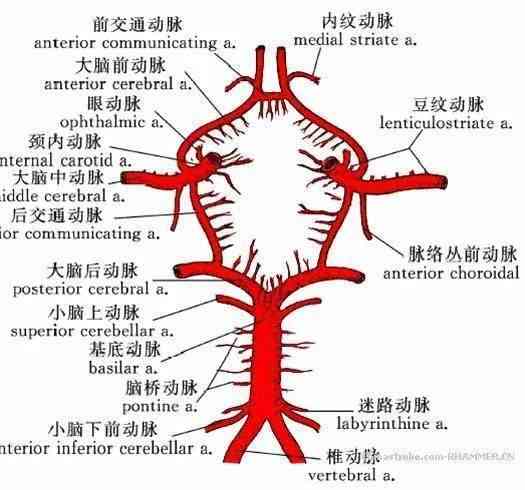 脑动脉瘤破裂与工伤认定：是否属于工伤及是否算重大疾病探讨