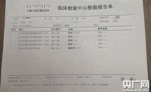 医护肺部感染认定工伤吗：能赔偿及赔偿标准，肺部感染工伤级别判定