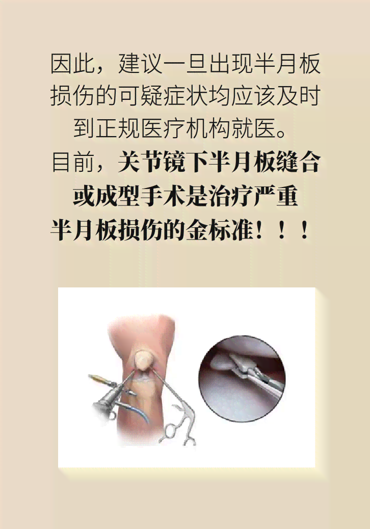 半月板损伤可认定工伤几级吗及能认定伤残等级和赔偿标准