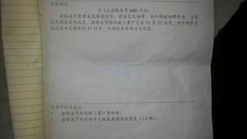 半月板损伤工伤认定好认定吗：工伤鉴定标准与伤残评定及赔偿解析-半月板损伤工伤鉴定有评上伤残的吗