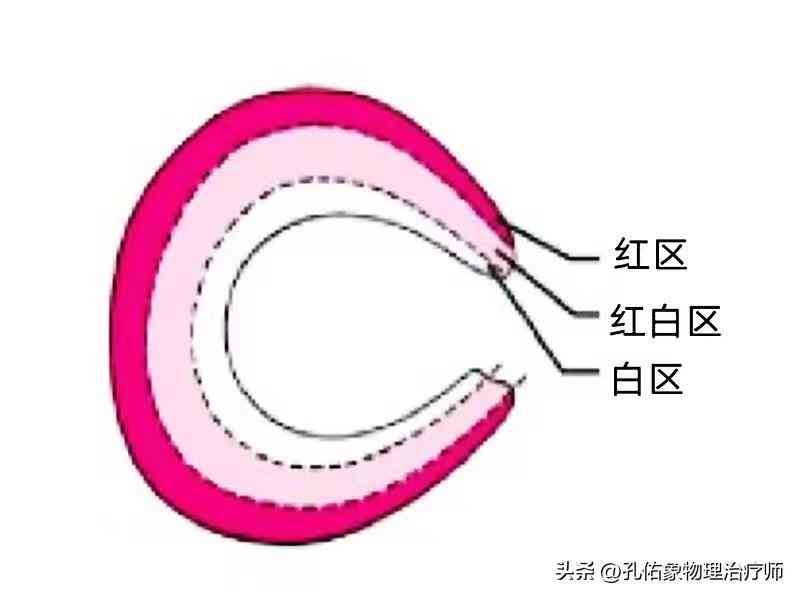 工伤认定：半月板损伤是否纳入工伤范畴》