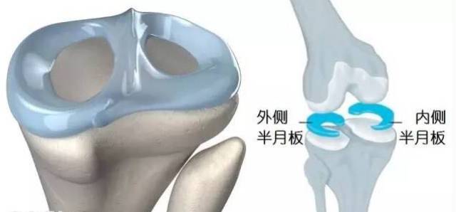 半月板损伤伤残等级评定与认定标准解析