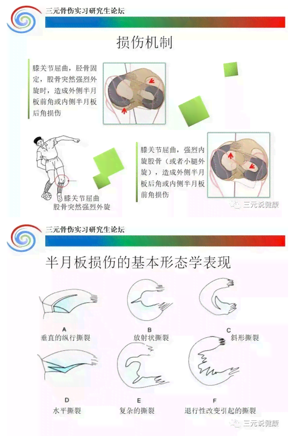 半月板损伤是否构成伤残等级评定标准解析