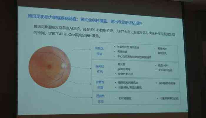 全面解读眼底照相机实验结果：数据分析、临床应用与未来展望