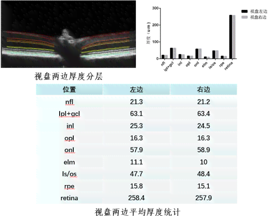 全面解读眼底照相机实验结果：数据分析、临床应用与未来展望