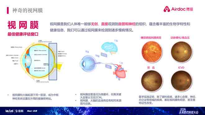 眼底照相机的ai报告