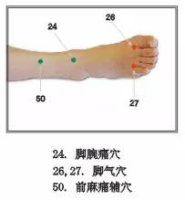 右腕关节损伤是啥病：症状、治疗方法及部位解析