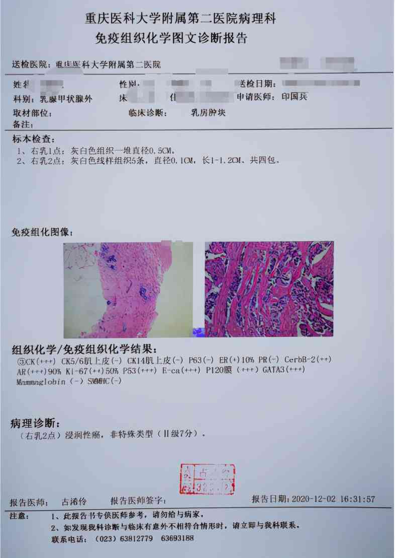 癌病理报告(-)癌症与癌变病理学意义解析