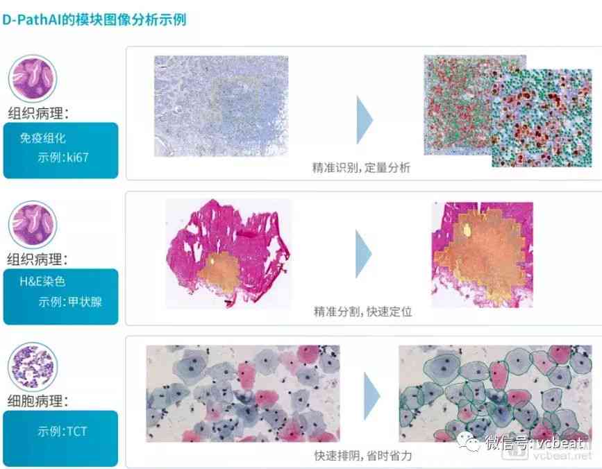 ai病理报告