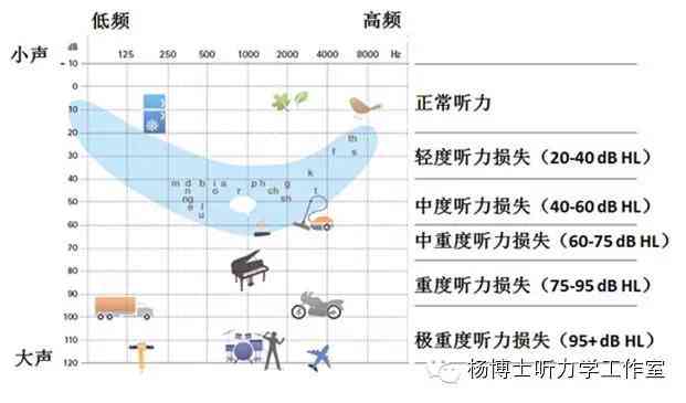 听力损失30分是否算作聋：深入了解听力阈值与耳聋标准