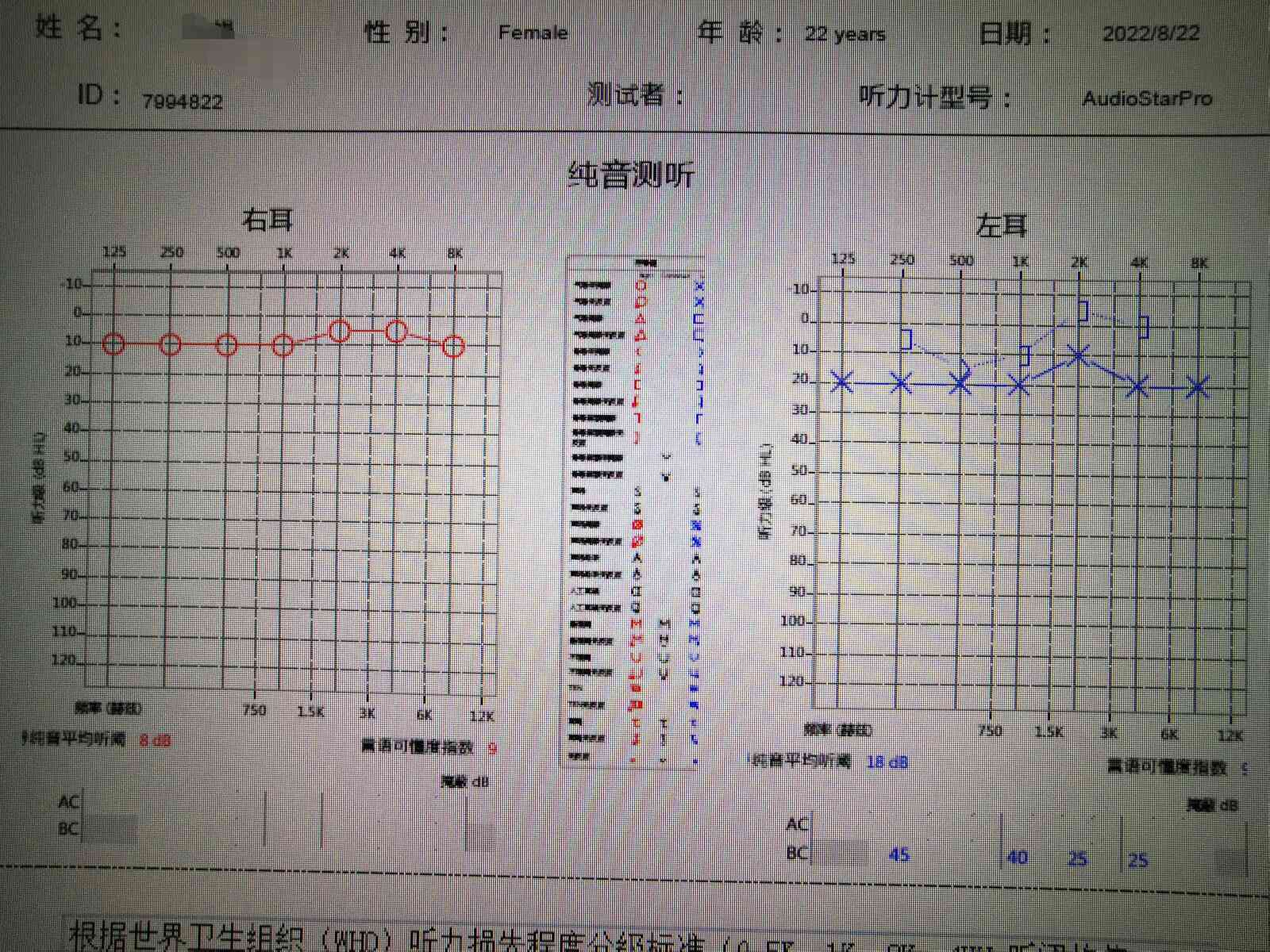 双耳听力30分正常与否及3000HZ受损情况探讨