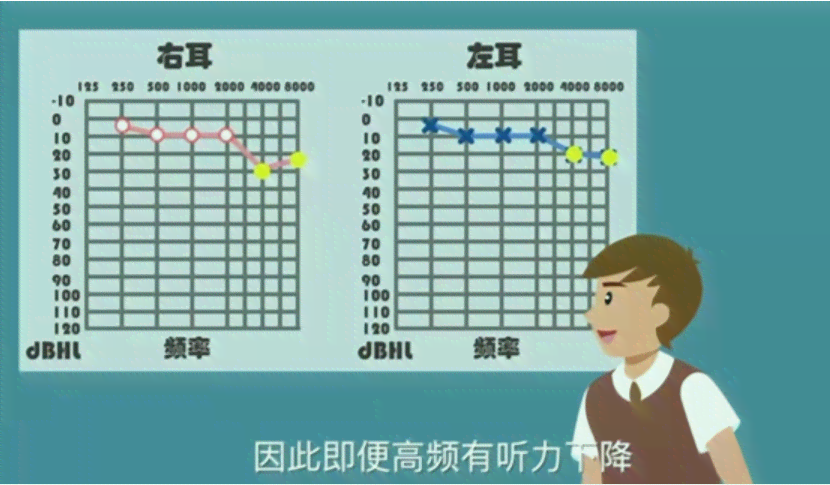 双耳听力35分严重吗：耳朵听力正常值与30分对比分析