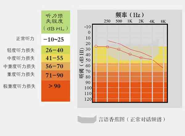 应对高频听力损失：科学干预与助听器选配策略