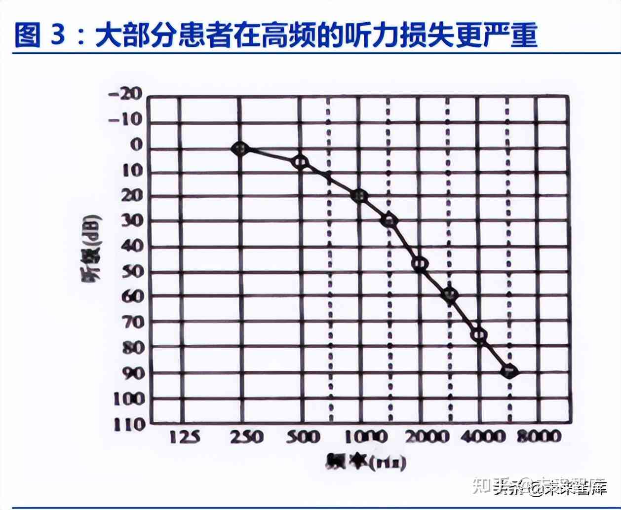 应对高频听力损失：科学干预与助听器选配策略