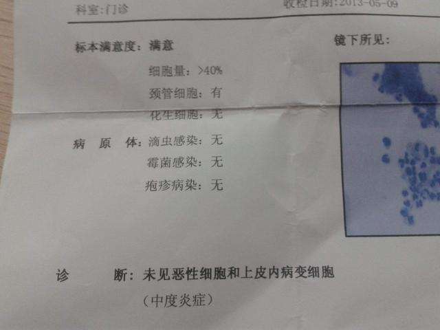 宫颈AI智能筛查解析：HPV与TCT报告单快速解读指南