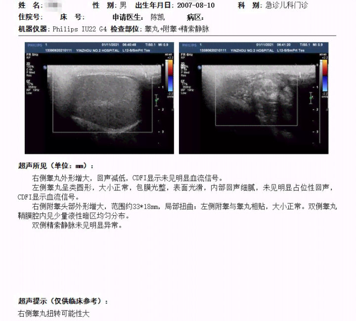 彩超报告AO：如何解读AC含义、查看报告单及等待结果时长