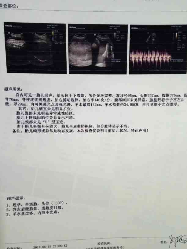 彩超报告AO：如何解读AC含义、查看报告单及等待结果时长