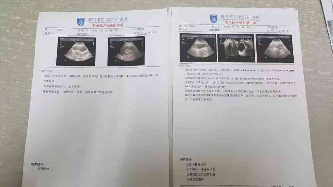 如何全面解读彩超报告单：涵各类检查项目与常见病症解析