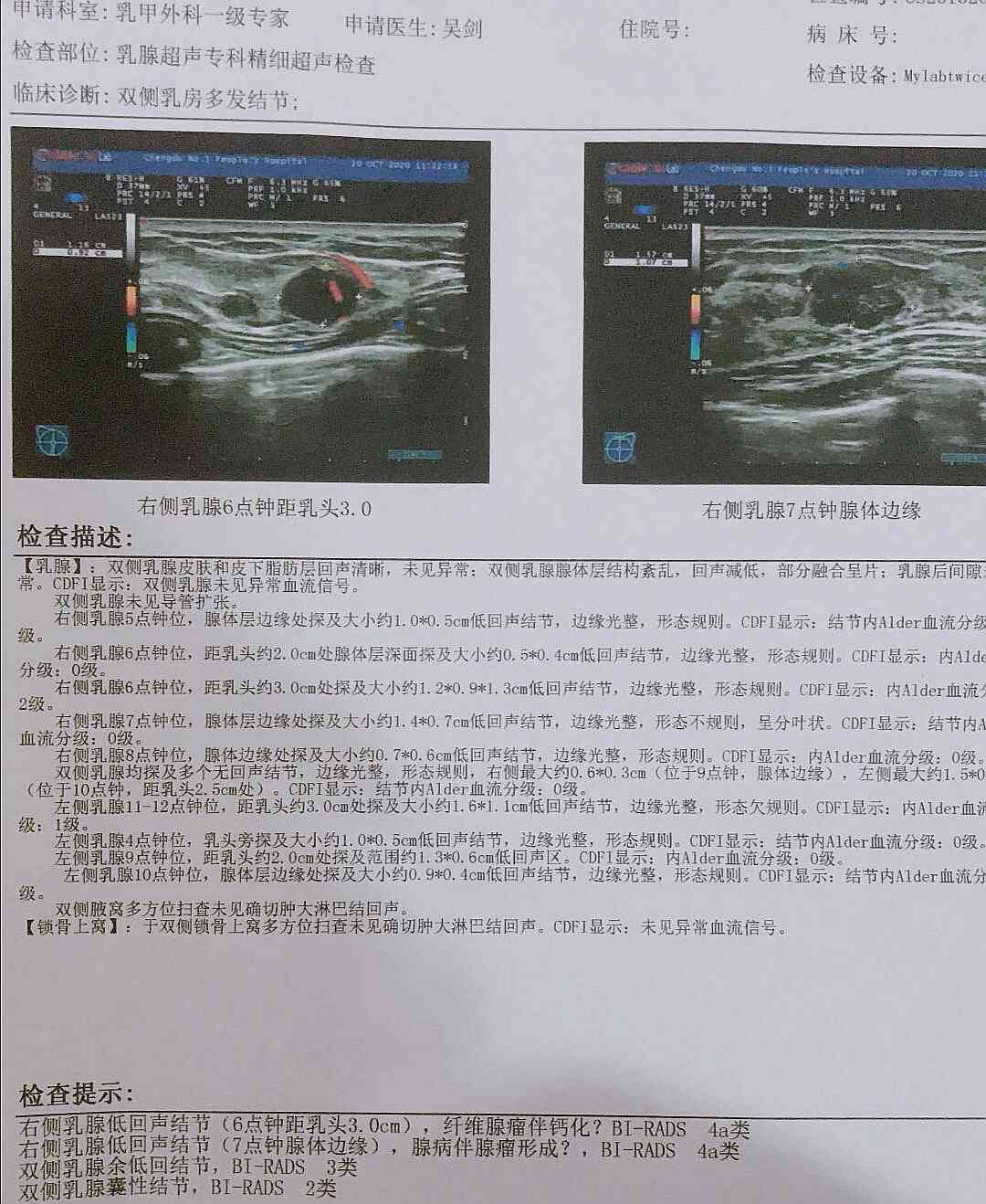 彩超报告一般要等多久出结果：乳腺彩超多久出正常报告