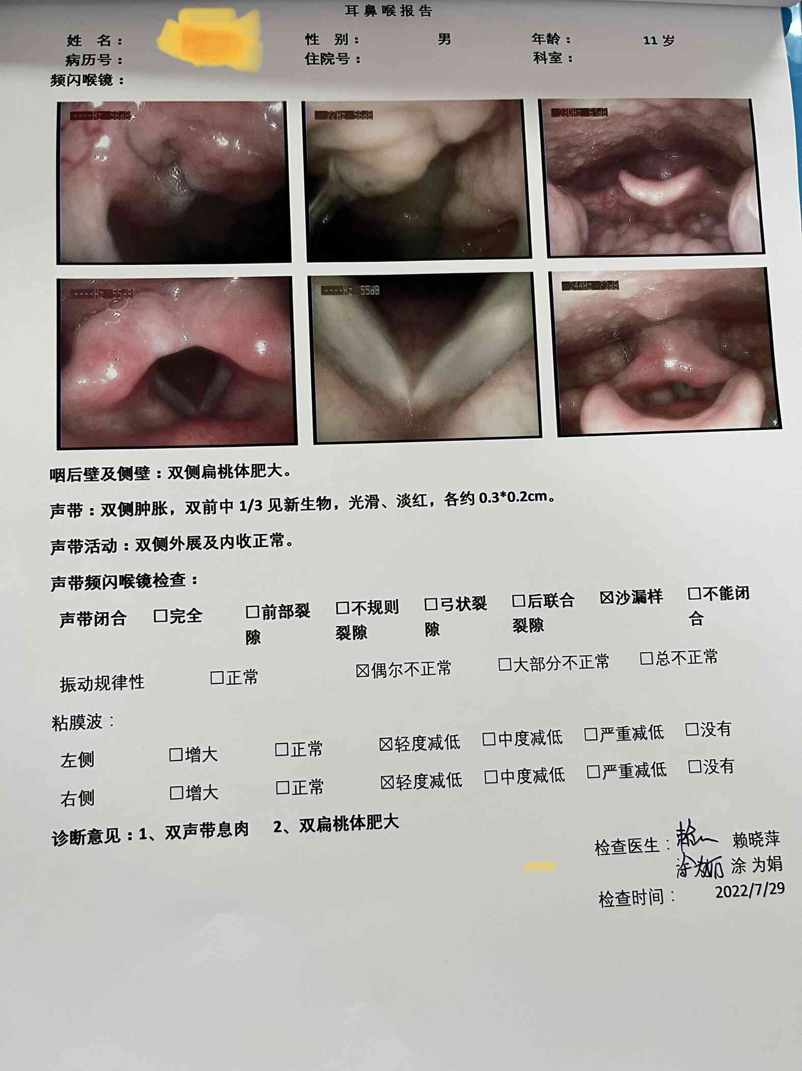 咽喉息肉手术可以报医保吗：医保报销情况及费用解析