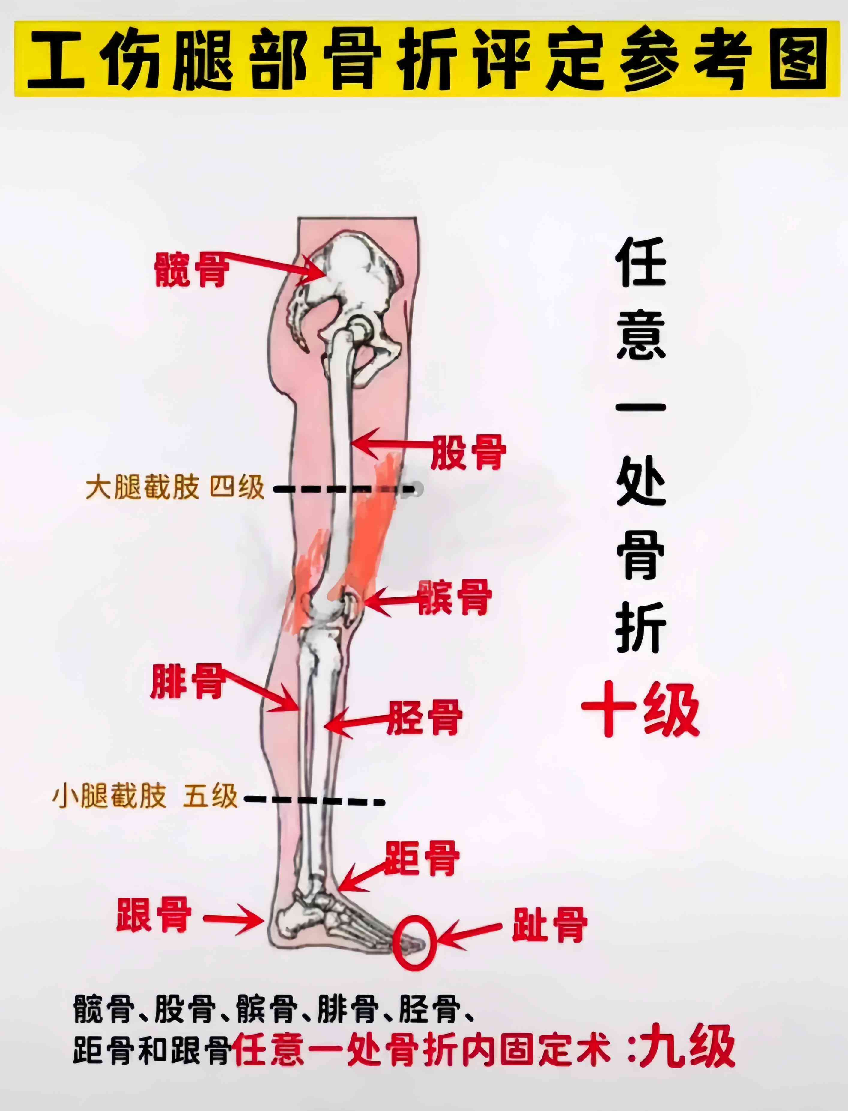 工伤等级认定禁忌：哪些人群不合工伤事故评级资格