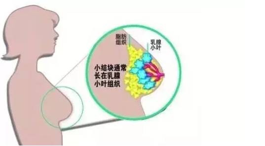 囊肿疾病保险理赔指南：哪些囊肿可以获得理赔支持