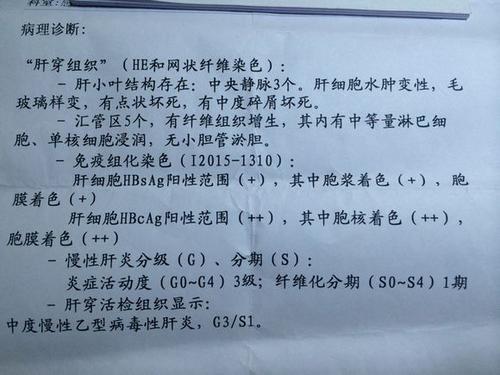 工伤认定：详解哪些情形合工伤事故标准