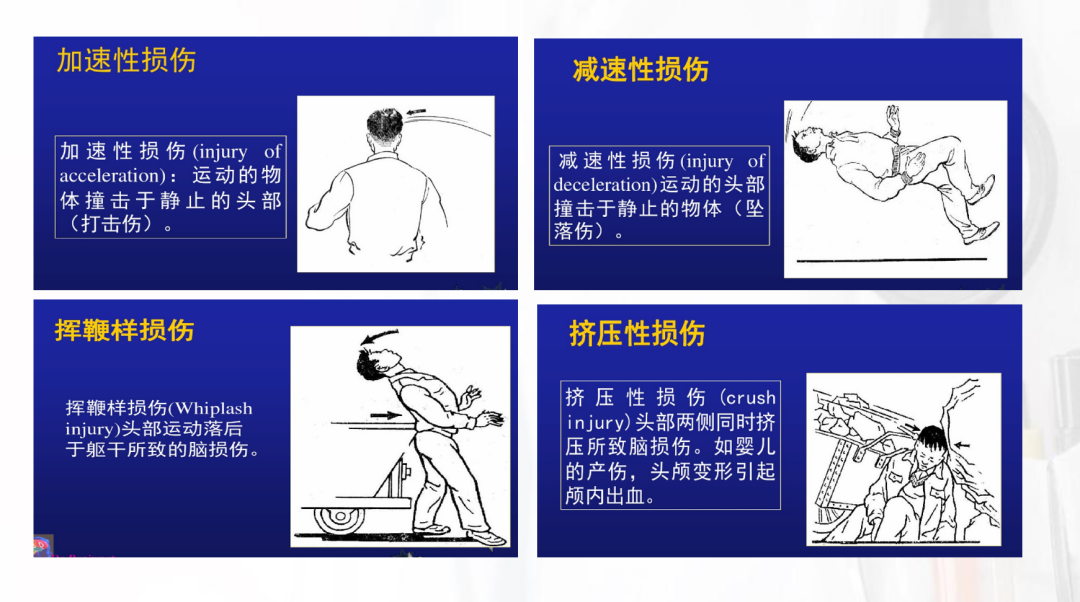 多发性挫伤损伤程度鉴定及法律意义解析