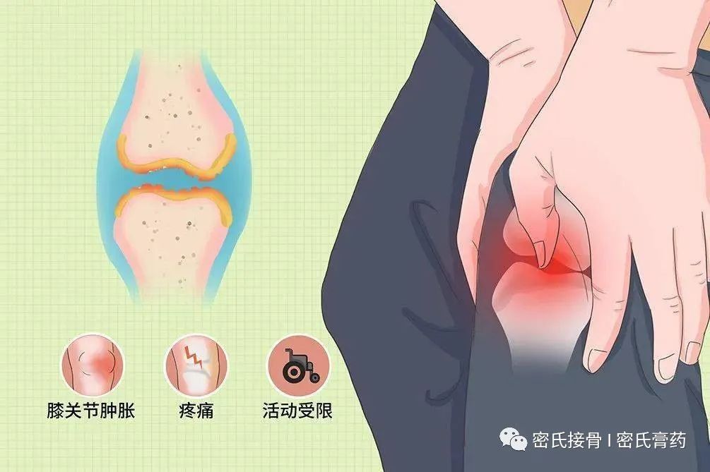 深入了解大关节脱位：原因、症状、治疗与预防全方位解析