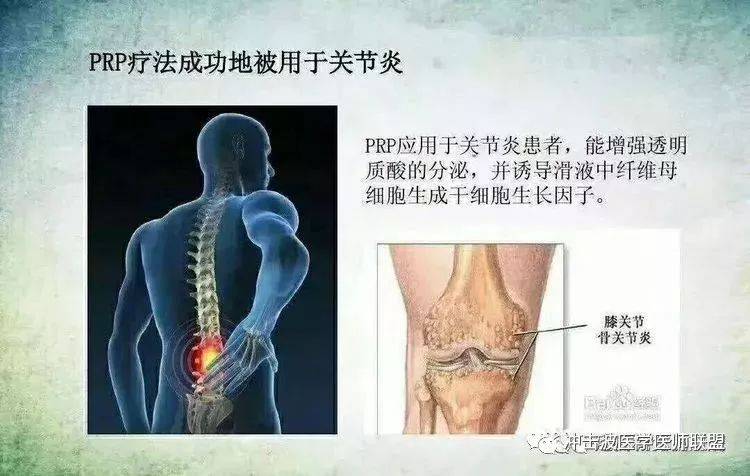 腿部肌肉缺失后能否实现再生与恢复：探讨原因、可能性及治疗方法