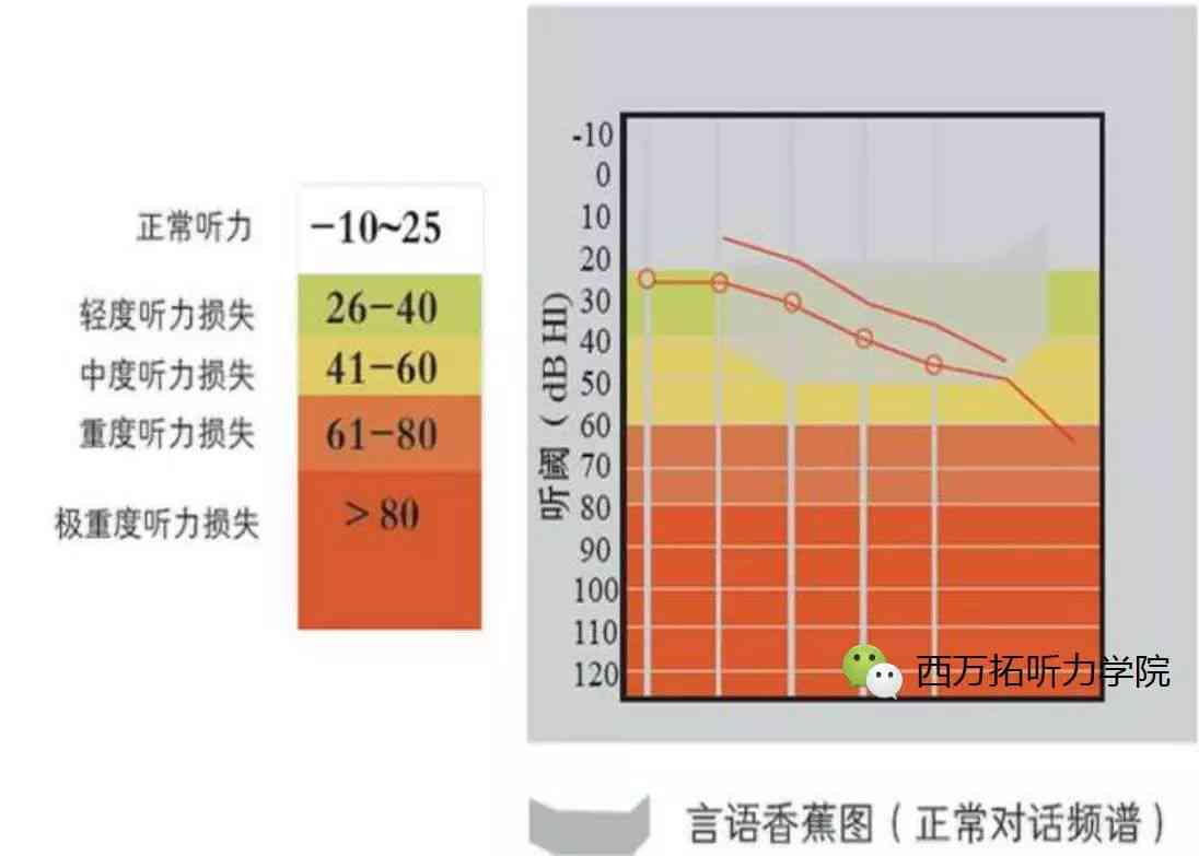 听力检测报告术语解读：全面解析各项字母代表的含义及意义